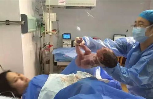 揭秘天使之吻胎记的消失概率及影响因素，让你了解如何护理与观察